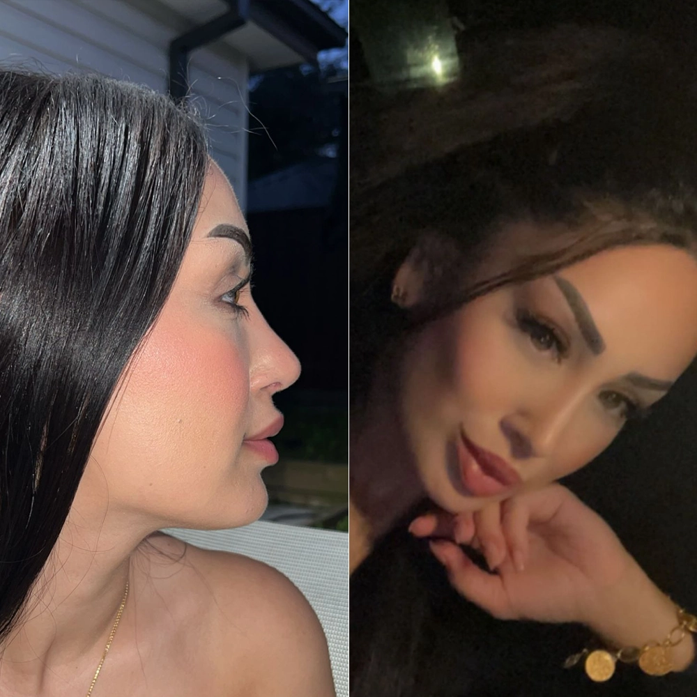 before after6