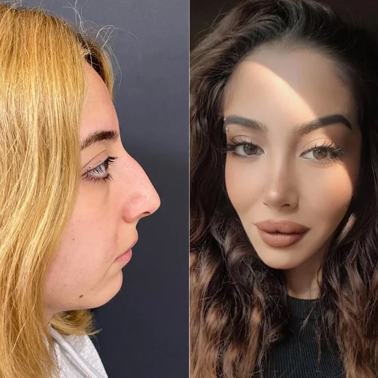 before after7