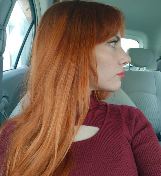 rhinoplasty-after